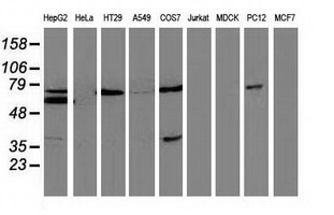 MSI1 Antibody in Western Blot (WB)