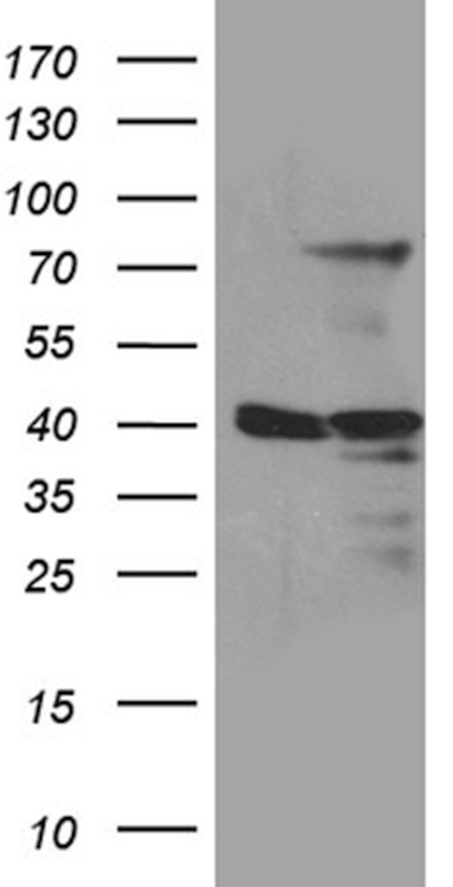 MSL2 Antibody in Western Blot (WB)