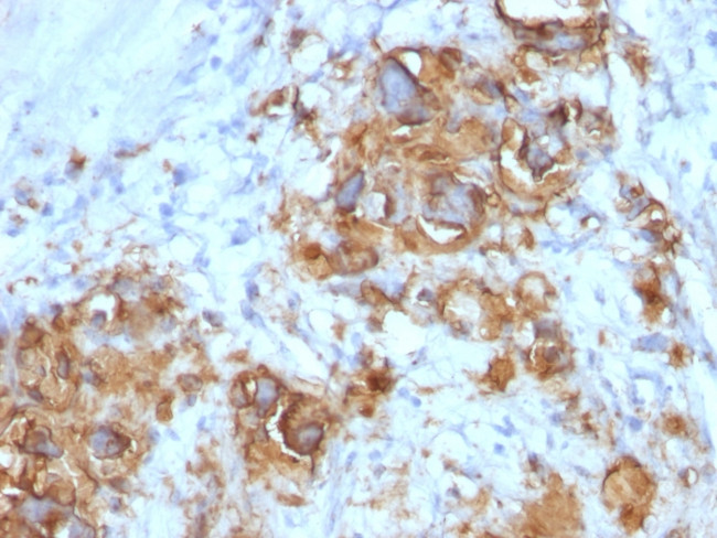 Ca19 9 Sialyl Lewisa Gi Tumor Marker Monoclonal Antibody 121sle