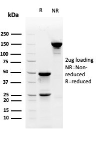 Myofibroblast Marker Antibody in SDS-PAGE (SDS-PAGE)