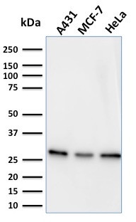 Myofibroblast Marker Antibody in Western Blot (WB)