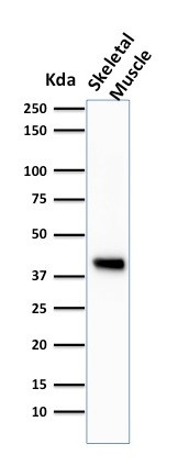 Actin, Muscle Specific (Muscle Cell Marker) Antibody in Western Blot (WB)