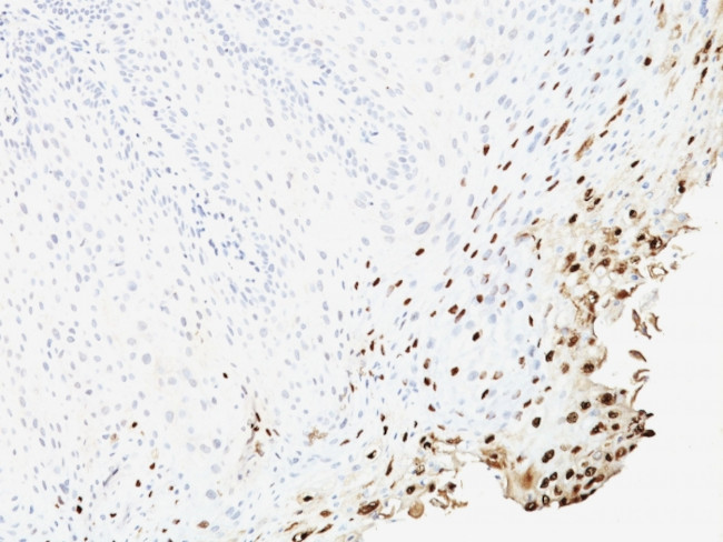 HPV-16 (Human Papilloma Virus 16) Antibody in Immunohistochemistry (Paraffin) (IHC (P))