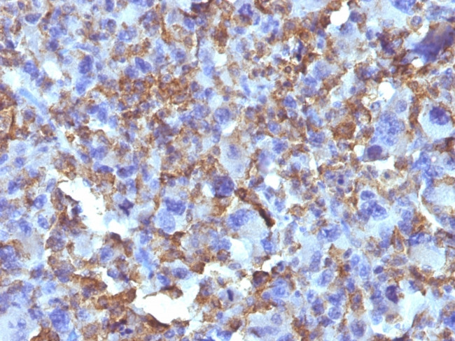 Macrophage and Histiocytoma Marker Antibody in Immunohistochemistry (Paraffin) (IHC (P))