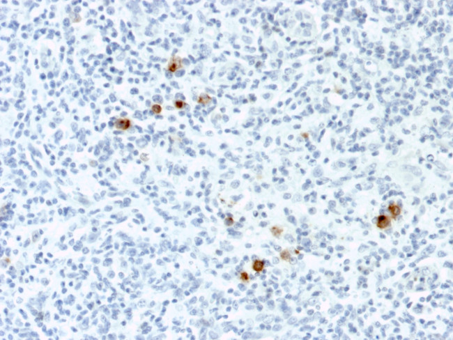 Epstein-Barr Virus (LMP-1) Antibody in Immunohistochemistry (Paraffin) (IHC (P))