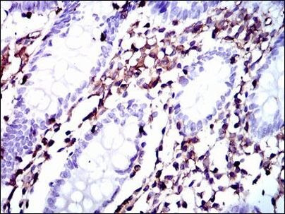 Moesin Antibody in Immunohistochemistry (Paraffin) (IHC (P))