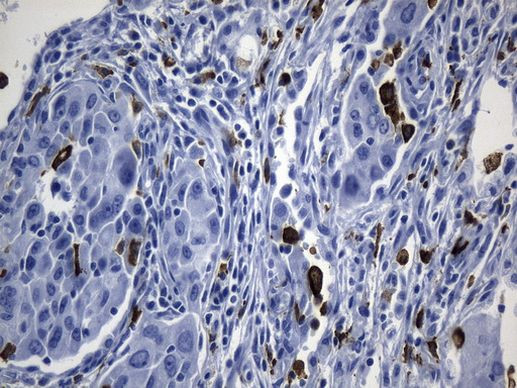 MSR1 Antibody in Immunohistochemistry (Paraffin) (IHC (P))