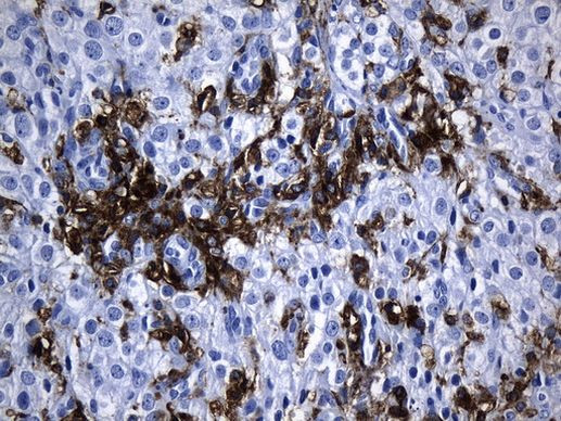 MSR1 Antibody in Immunohistochemistry (Paraffin) (IHC (P))