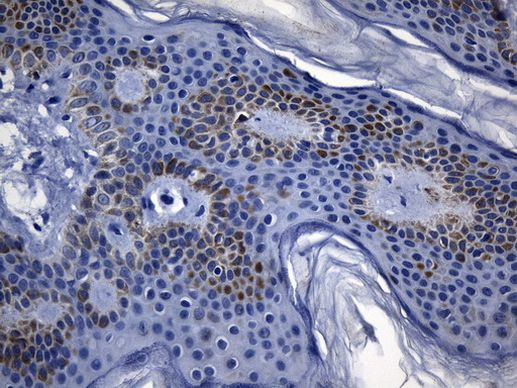 MSR1 Antibody in Immunohistochemistry (Paraffin) (IHC (P))