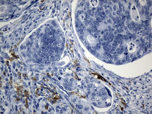 MSR1 Antibody in Immunohistochemistry (Paraffin) (IHC (P))