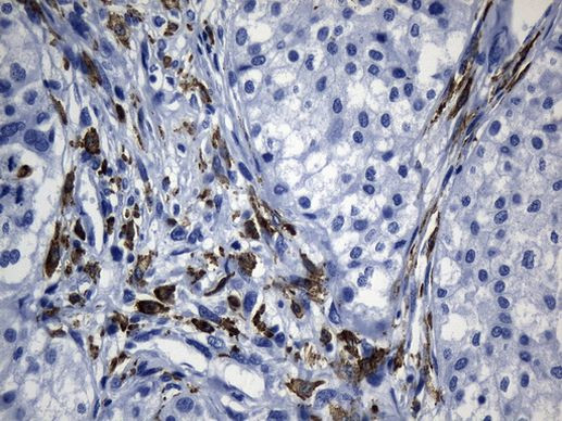 MSR1 Antibody in Immunohistochemistry (Paraffin) (IHC (P))