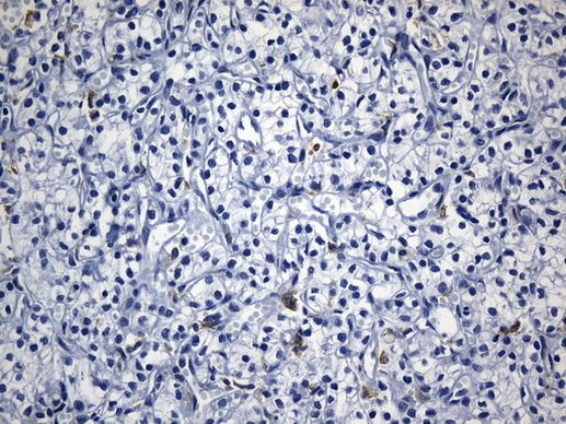 MSR1 Antibody in Immunohistochemistry (Paraffin) (IHC (P))