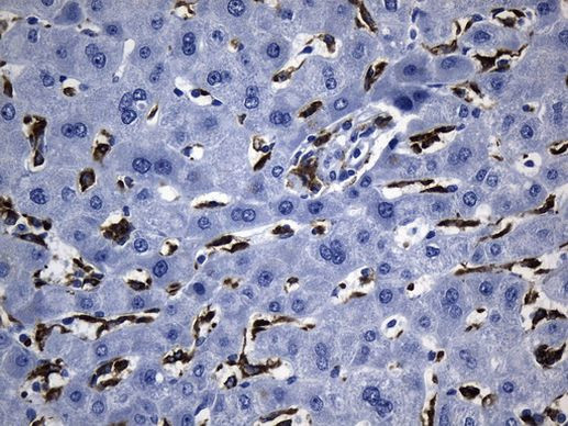 MSR1 Antibody in Immunohistochemistry (Paraffin) (IHC (P))