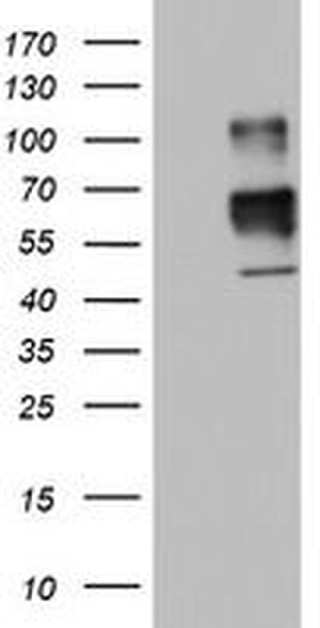 MSR1 Antibody in Western Blot (WB)