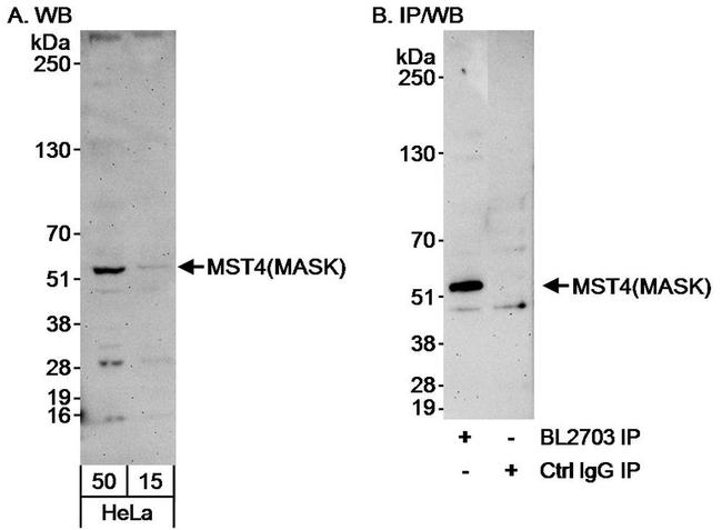 MST4/MASK Antibody in Western Blot (WB)