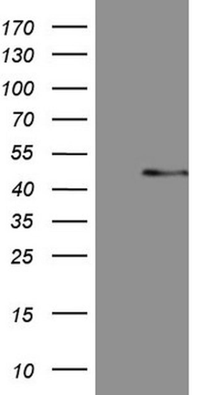 MSTN Antibody in Western Blot (WB)