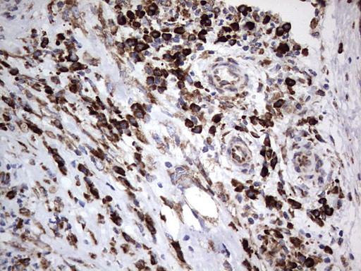 MTDH Antibody in Immunohistochemistry (Paraffin) (IHC (P))