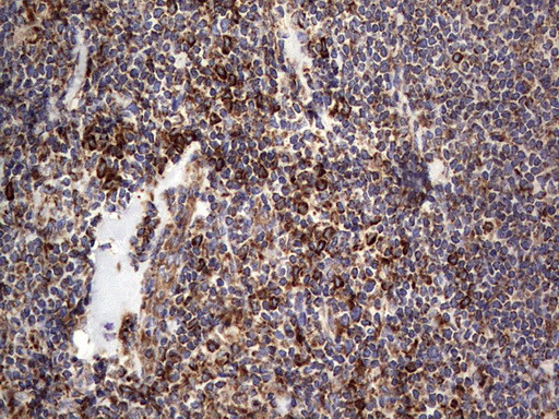 MTDH Antibody in Immunohistochemistry (Paraffin) (IHC (P))