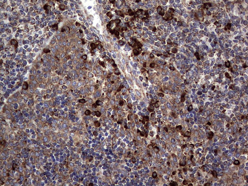 MTDH Antibody in Immunohistochemistry (Paraffin) (IHC (P))