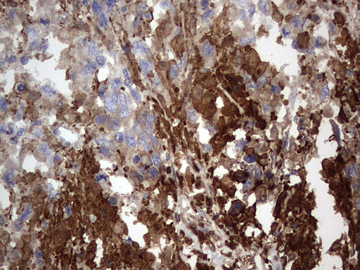 MTDH Antibody in Immunohistochemistry (Paraffin) (IHC (P))