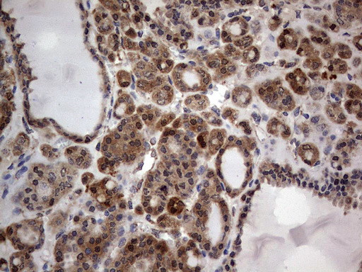 MTDH Antibody in Immunohistochemistry (Paraffin) (IHC (P))