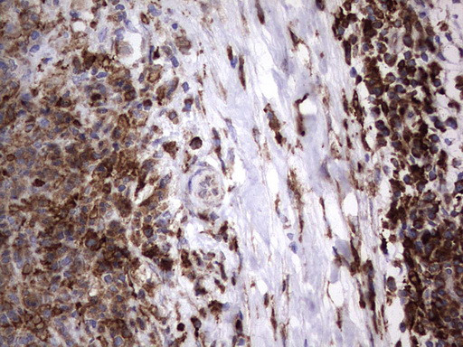 MTDH Antibody in Immunohistochemistry (Paraffin) (IHC (P))