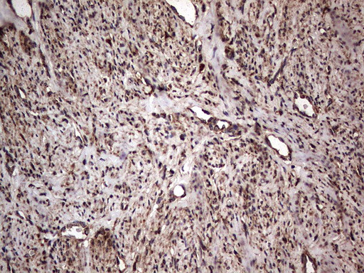 MTDH Antibody in Immunohistochemistry (Paraffin) (IHC (P))