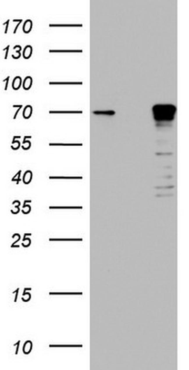 MTDH Antibody in Western Blot (WB)