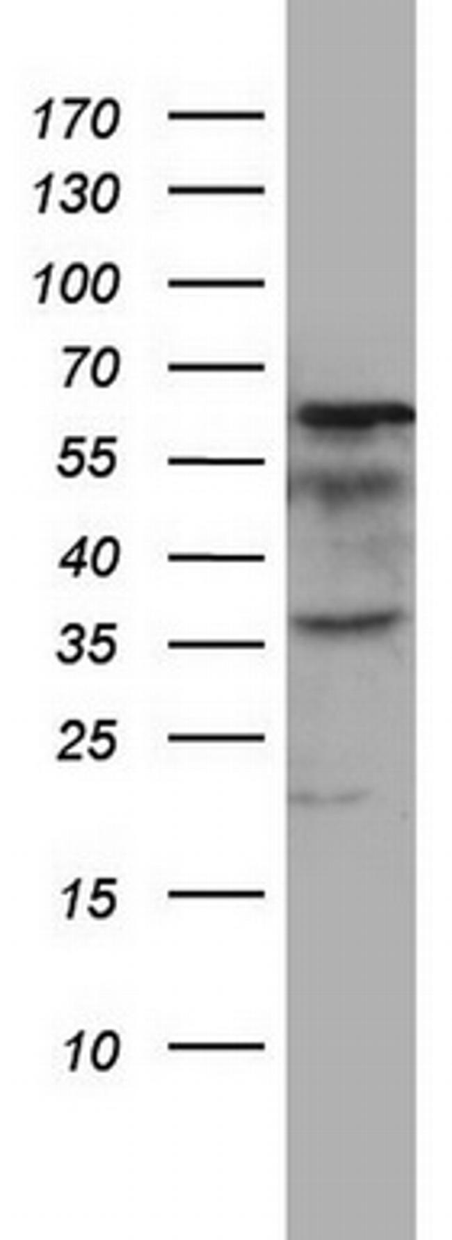 MTDH Antibody in Western Blot (WB)