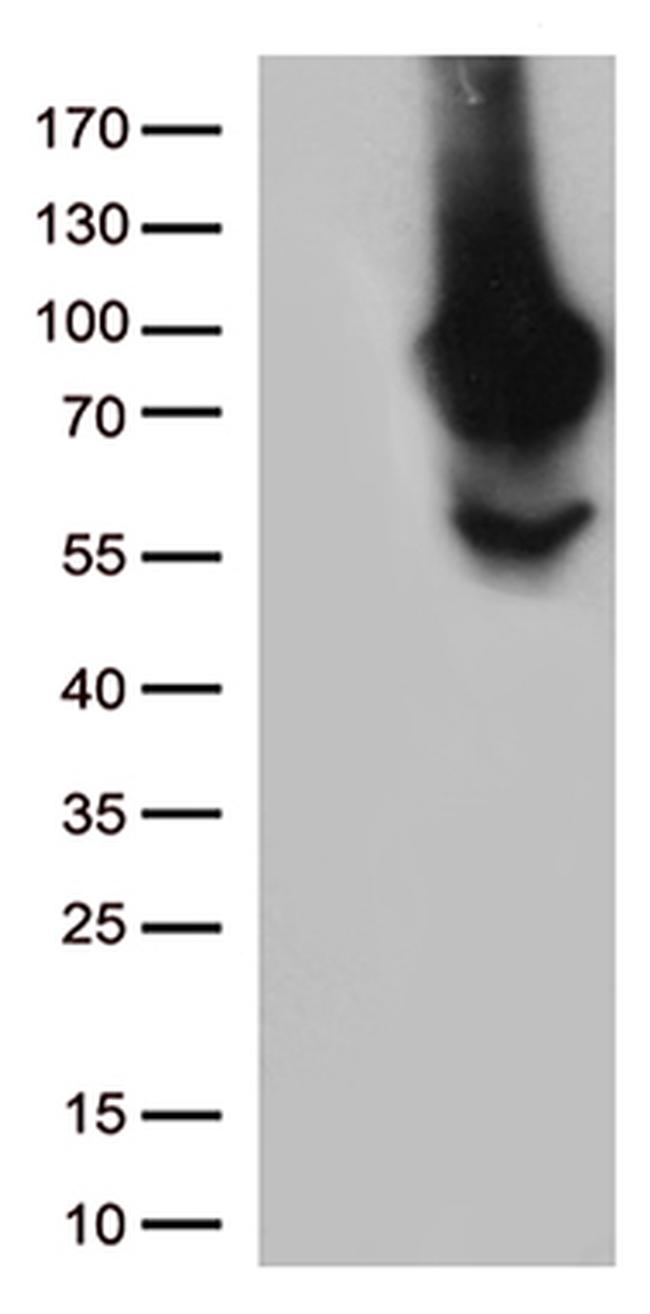 MTHFR Antibody in Western Blot (WB)