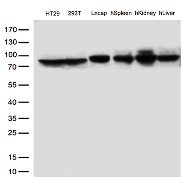 MTHFR Antibody in Western Blot (WB)