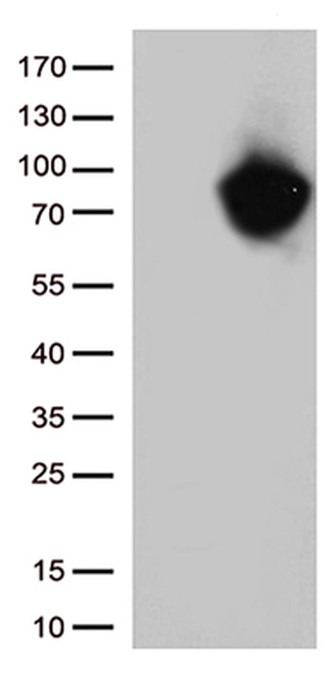 MTHFR Antibody in Western Blot (WB)