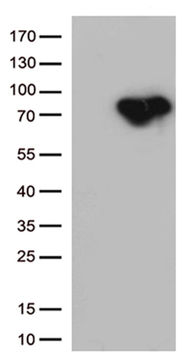 MTHFR Antibody in Western Blot (WB)