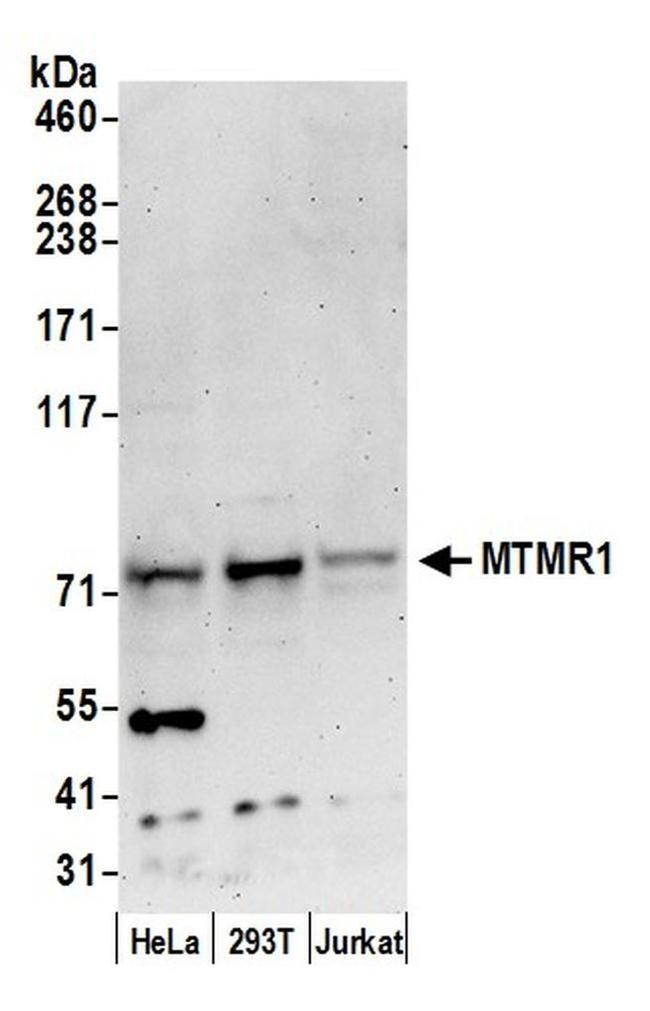 MTMR1 Antibody in Western Blot (WB)