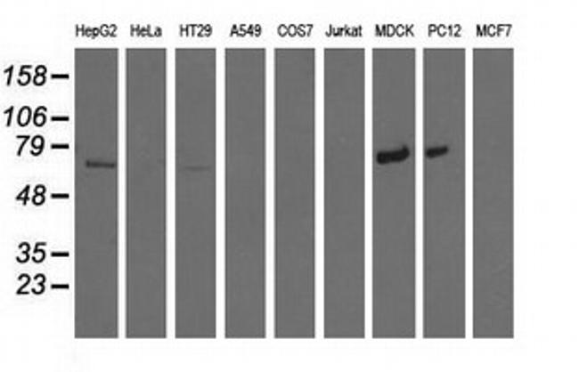 MTMR14 Antibody in Western Blot (WB)