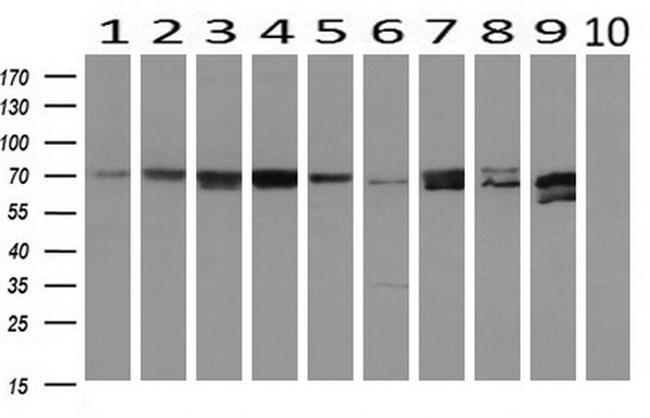 MTMR14 Antibody in Western Blot (WB)