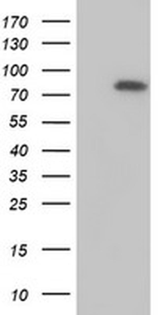 MTMR2 Antibody in Western Blot (WB)