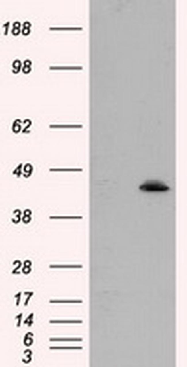 MTRF1L Antibody in Western Blot (WB)