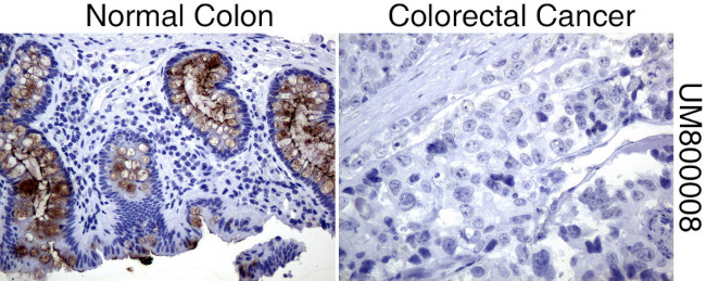 MUC1 Antibody in Immunohistochemistry (Paraffin) (IHC (P))