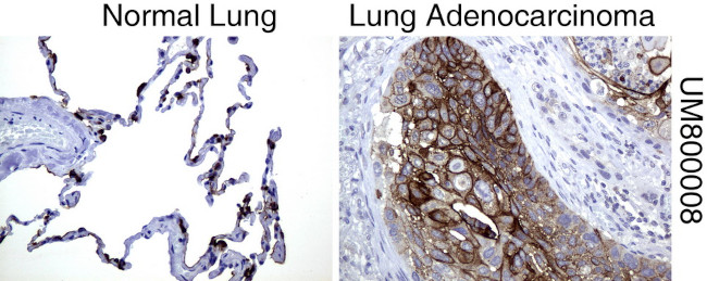 MUC1 Antibody in Immunohistochemistry (Paraffin) (IHC (P))