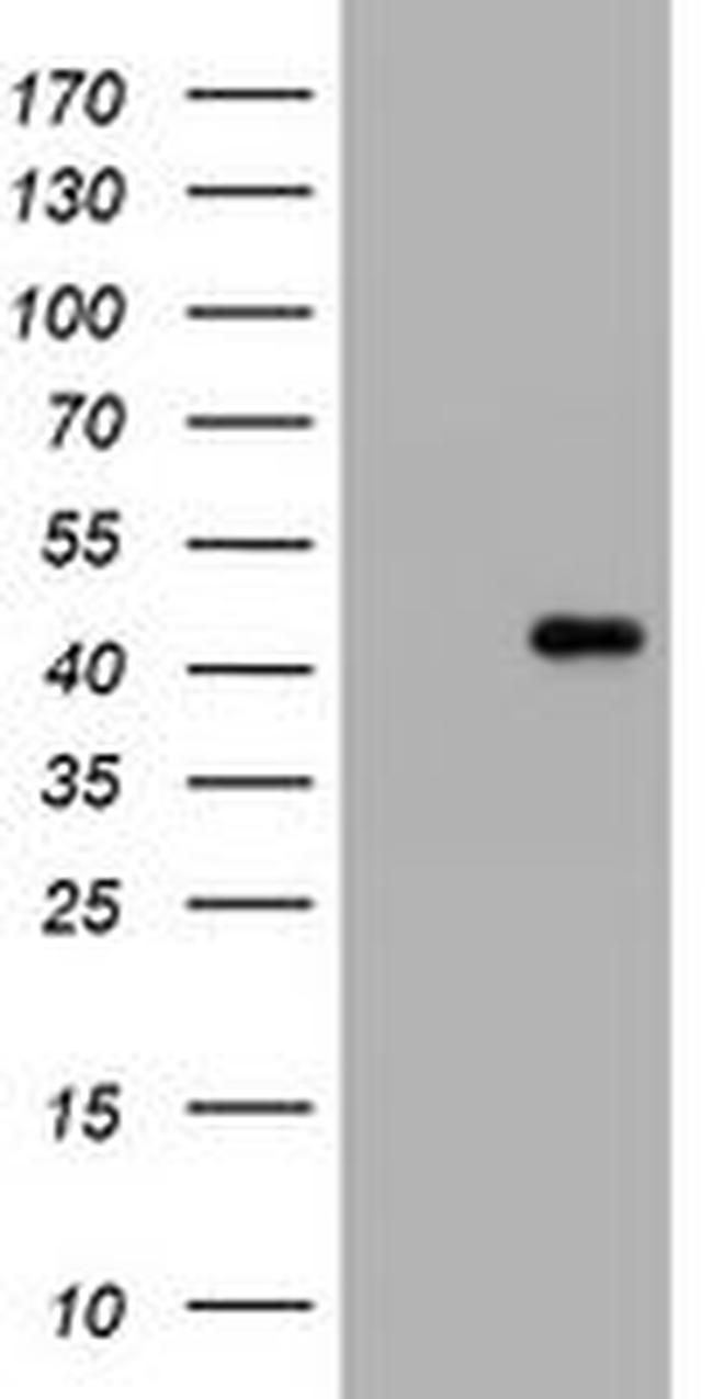 MUC16 Antibody in Western Blot (WB)