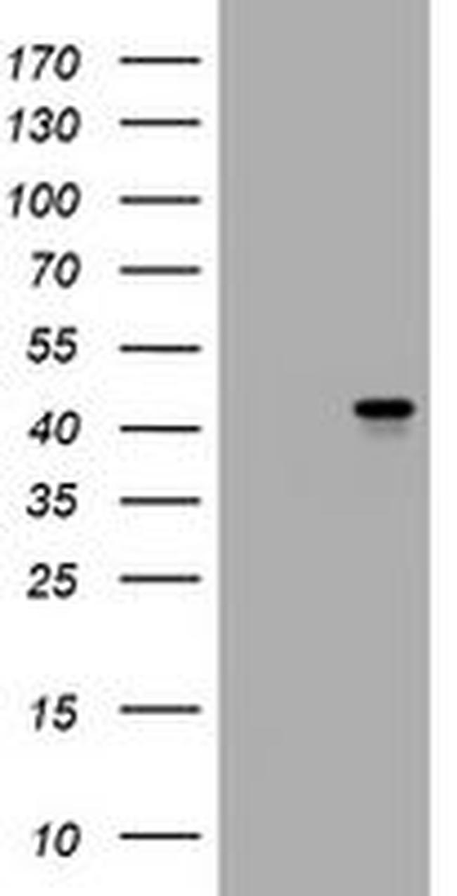 MUC16 Antibody in Western Blot (WB)