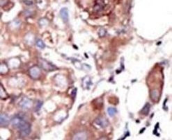 MUSK Antibody in Immunohistochemistry (IHC)