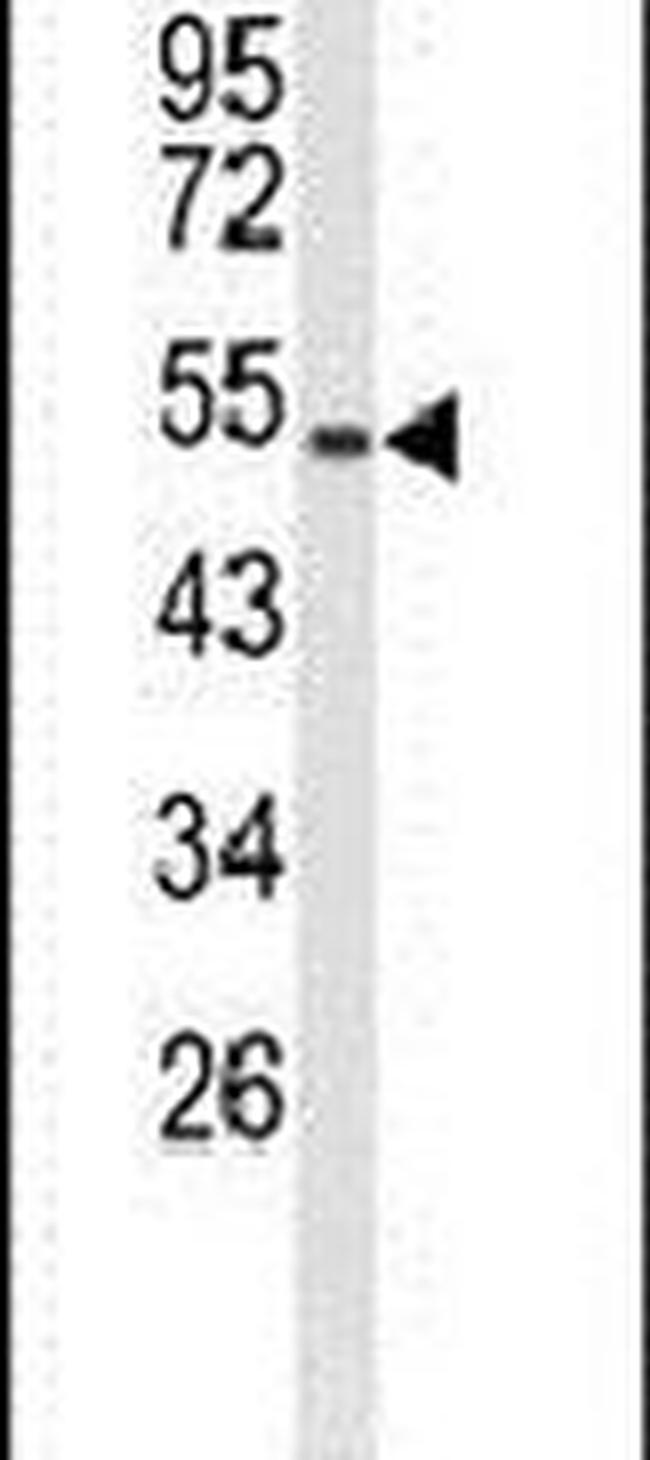 MUTYH Antibody in Western Blot (WB)