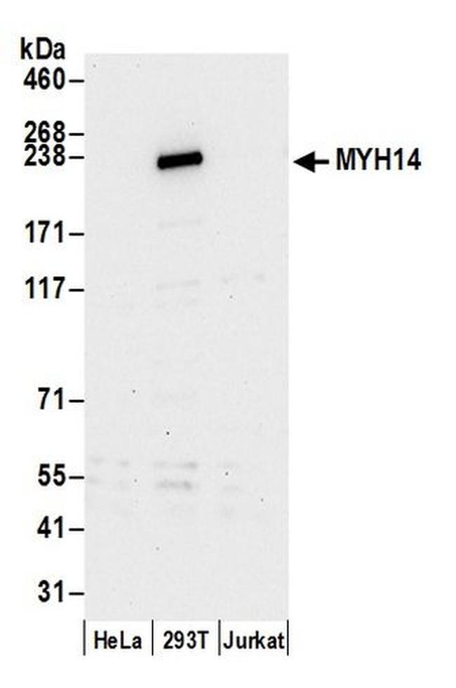 MYH14/Myosin-14 Antibody in Western Blot (WB)