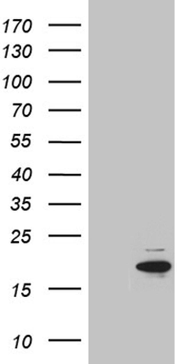 MYL1 Antibody in Western Blot (WB)