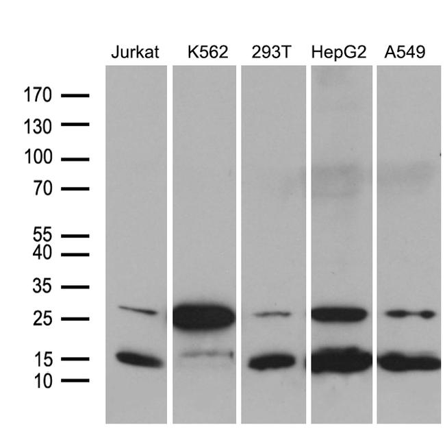 MYL1 Antibody in Western Blot (WB)