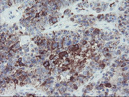 MYL7 Antibody in Immunohistochemistry (Paraffin) (IHC (P))