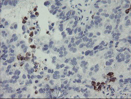 MYL7 Antibody in Immunohistochemistry (Paraffin) (IHC (P))