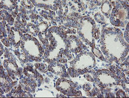 MYL7 Antibody in Immunohistochemistry (Paraffin) (IHC (P))